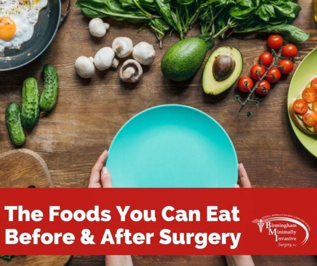 weight-loss-surgery-diets-what-you-can-eat-when-birmingham