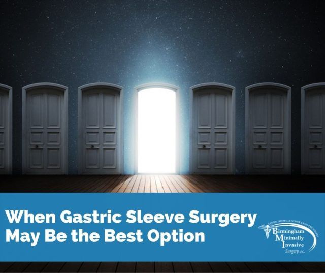 When Gastric Sleeve Surgery May Be The Best Option Birmingham Minimally Invasive Surgery 2671