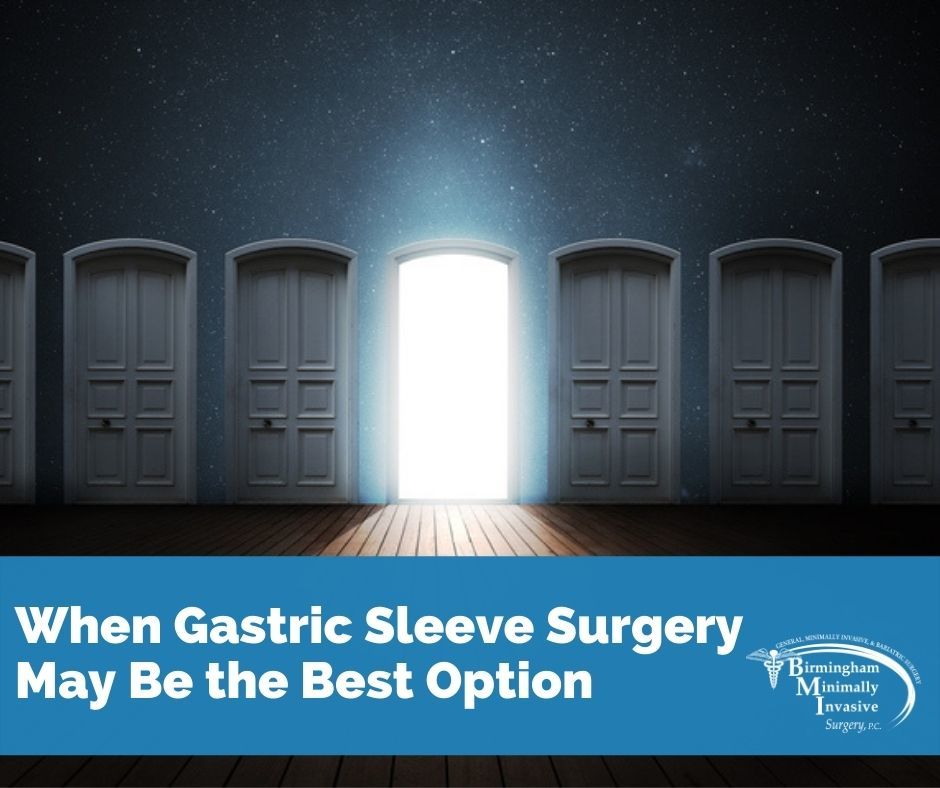 When Gastric Sleeve Surgery May Be The Best Option Birmingham Minimally Invasive Surgery