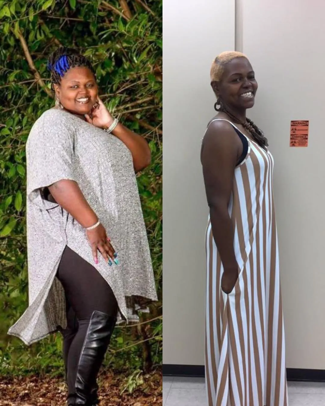Before-and-after weight-loss photo of a smiling woman in a gray tunic and a brown-and-white striped maxi dress