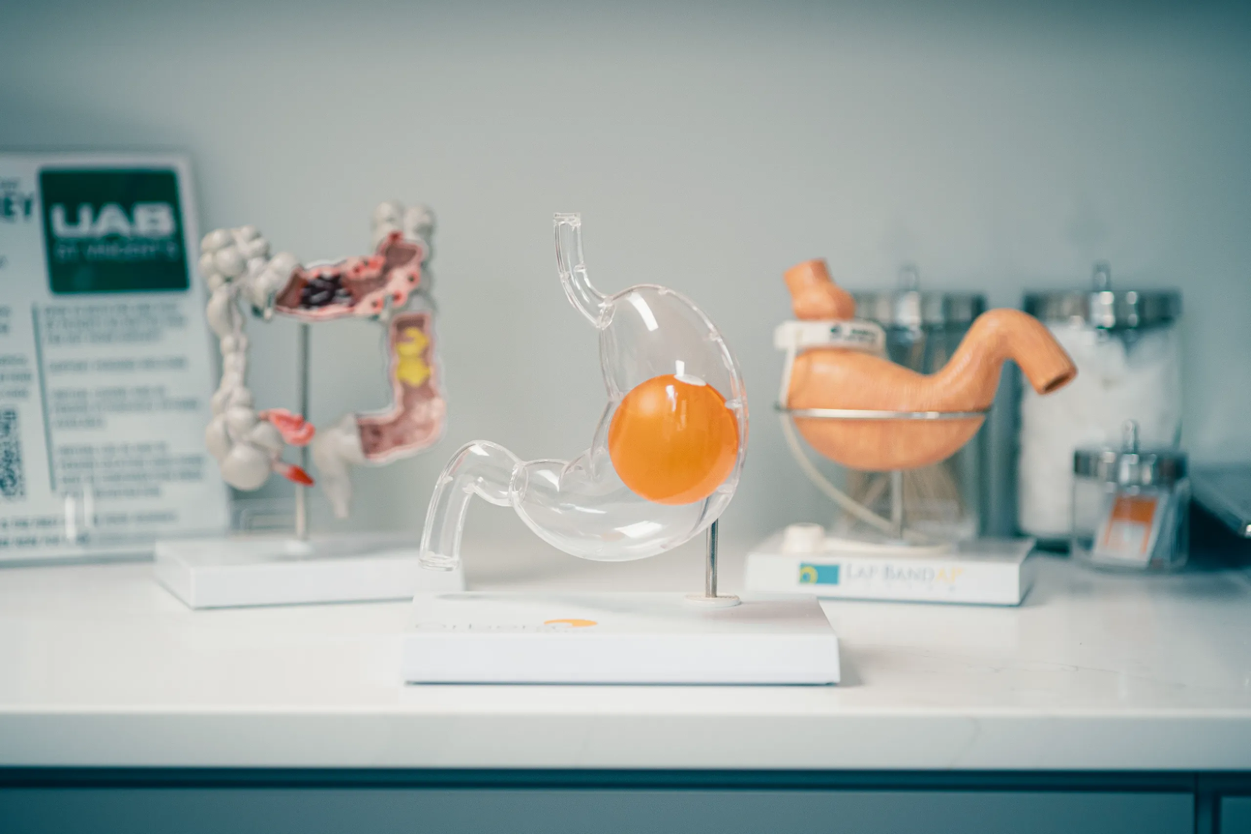 Clear stomach model with orange intragastric balloon on display in bariatric clinic with anatomy models