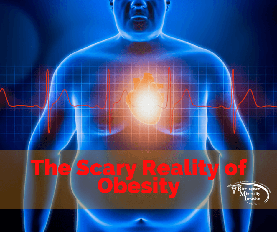 reality of obesity