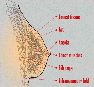 Labeled cross-section diagram of a woman's breast anatomy showing breast tissue, fat, areola, chest muscles, rib cage